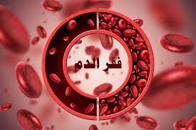 علاج فقر الدم